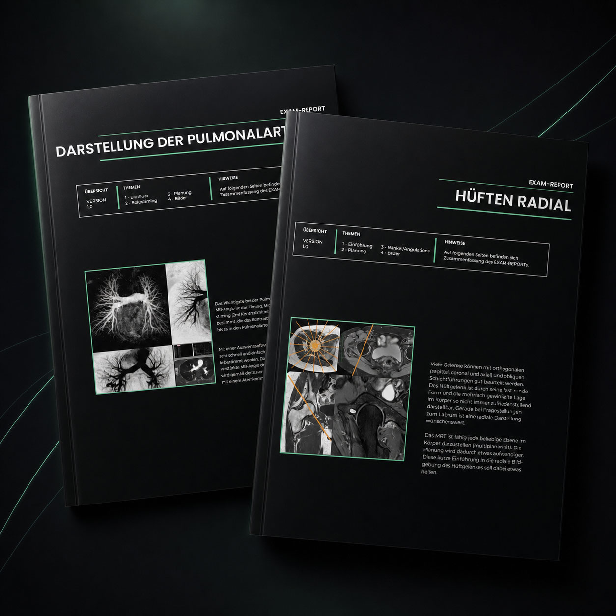 Reports Mockup