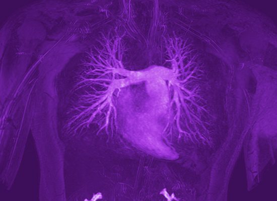 pulmonalarteria