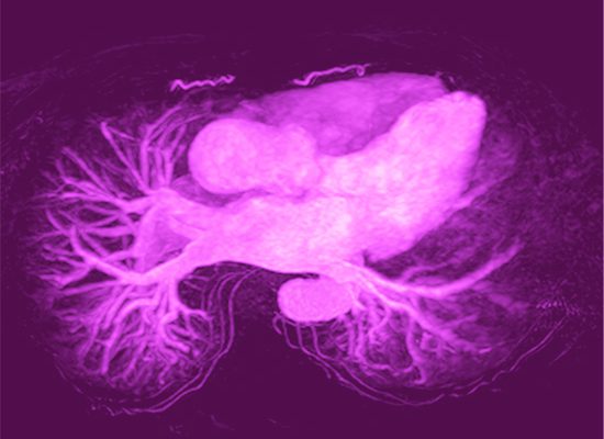pulmonalvene
